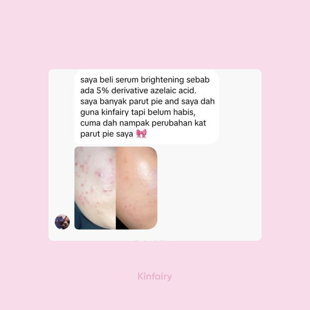 Anti-Scar Glow Serum